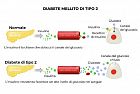 Nuove frontiere terapeutiche per il diabete di tipo 2