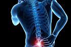 I dolori alla schiena e alla colonna vertebrale non risparmiano neanche gli sportivi
